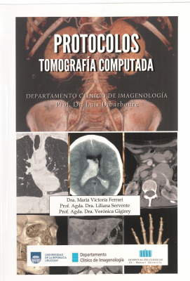 Protocolos : tomograf&iacute;a computada