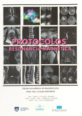 Protocolos : resonancia magn&eacute;tica
