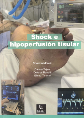 Shock e hipoperfusi&oacute;n tisular