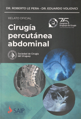 Cirug&iacute;a percut&aacute;nea abdominal : relato oficial