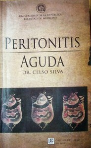 Peritonitis aguda