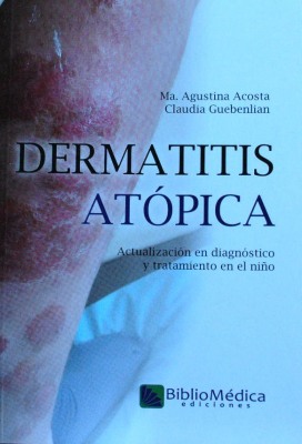 Dermatitis atópica : actualización en diagnóstico y tratamiento en el niño