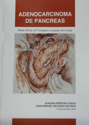 Adenocarcinoma de páncreas